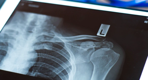 cat-digital-radiology-second